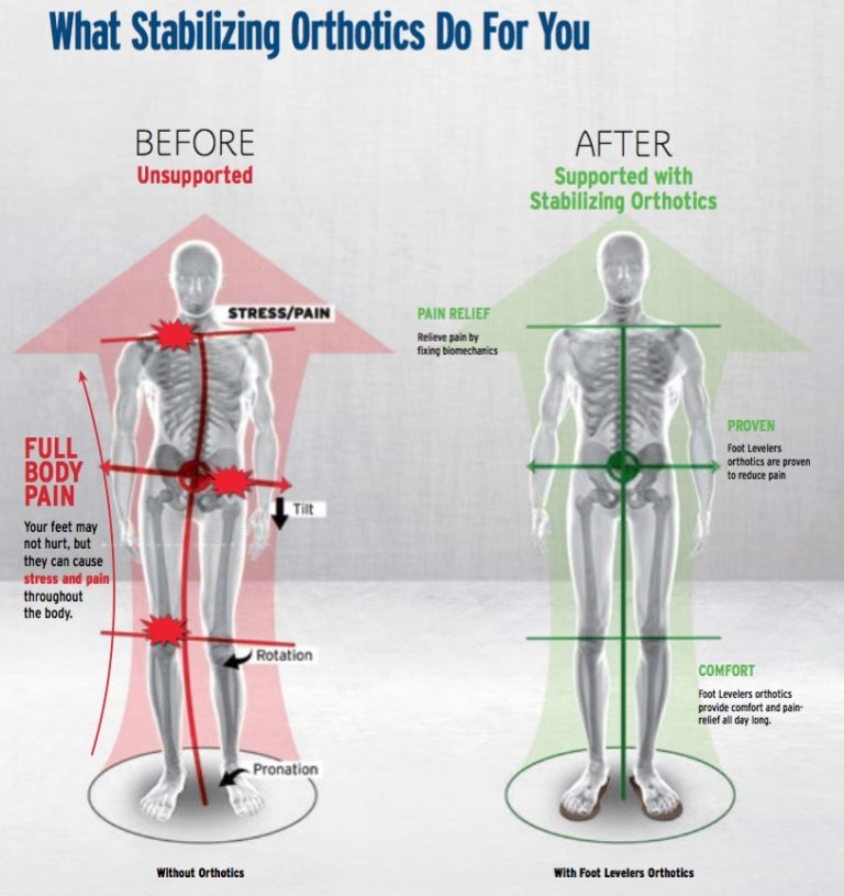 Foot Levelers Suncoast Chiropractic